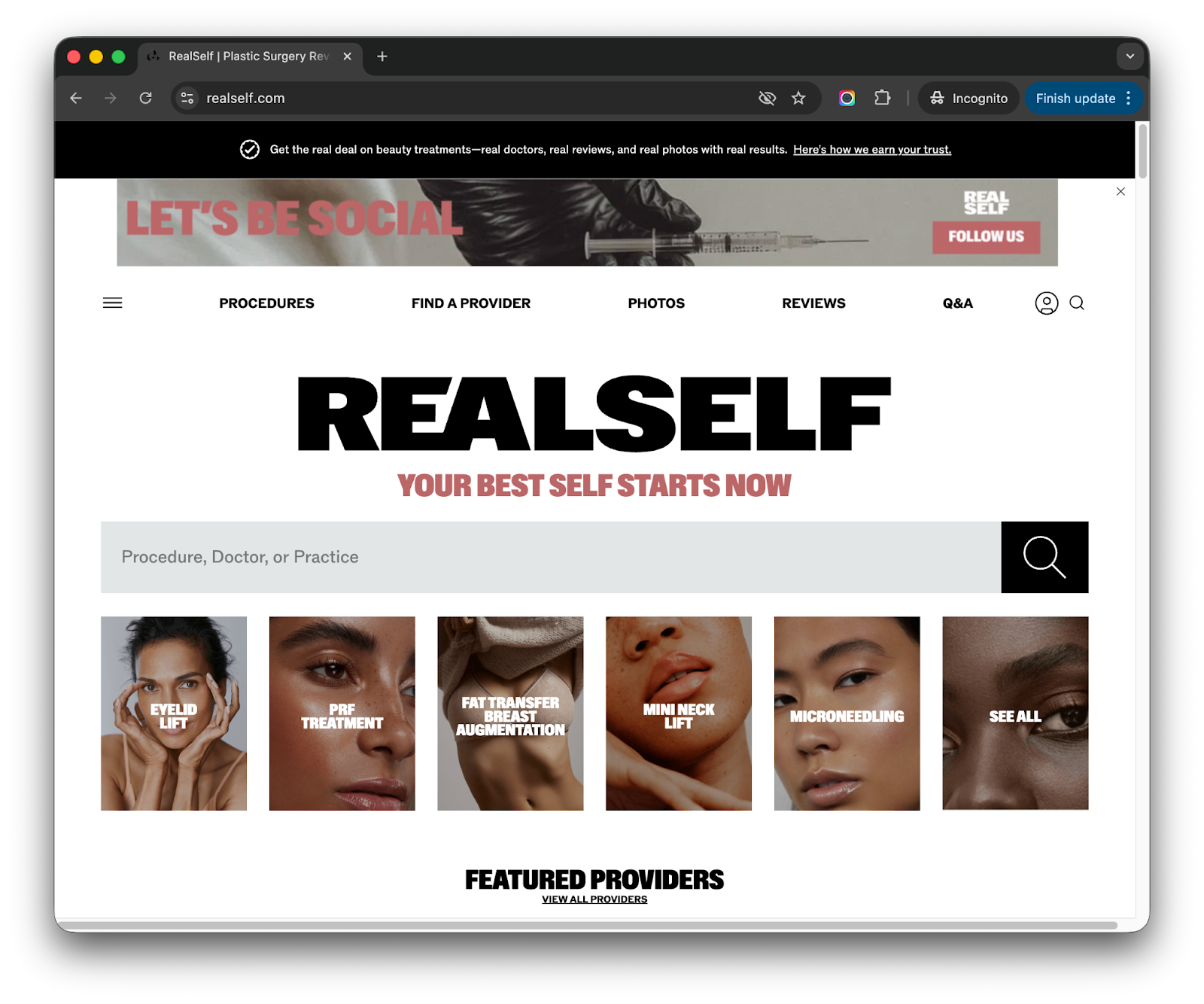 RealSelf homepage for cosmetic procedure reviews and finding plastic surgeons - Smart Reviews